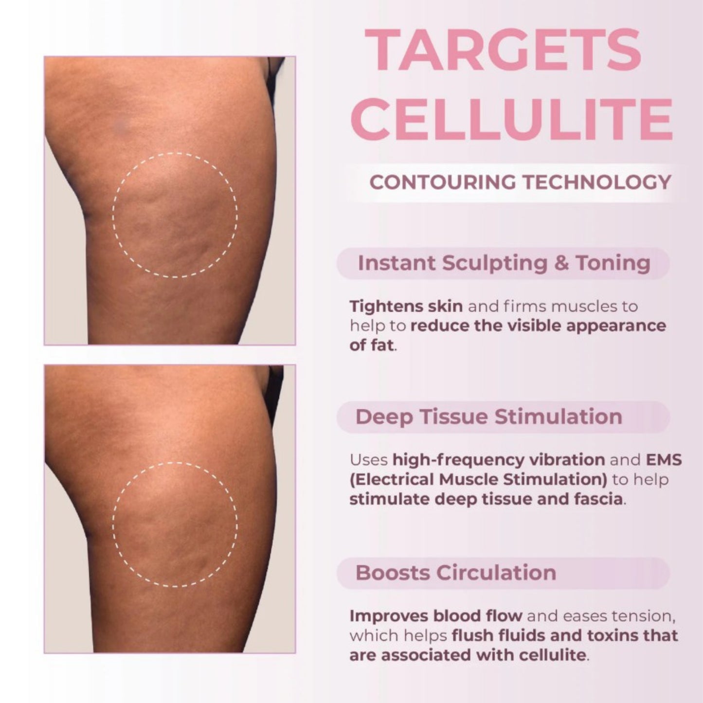 Virelle Beauty High-Frequency Massage Sculptor